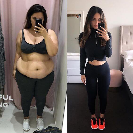 Before and After Weight Management Results