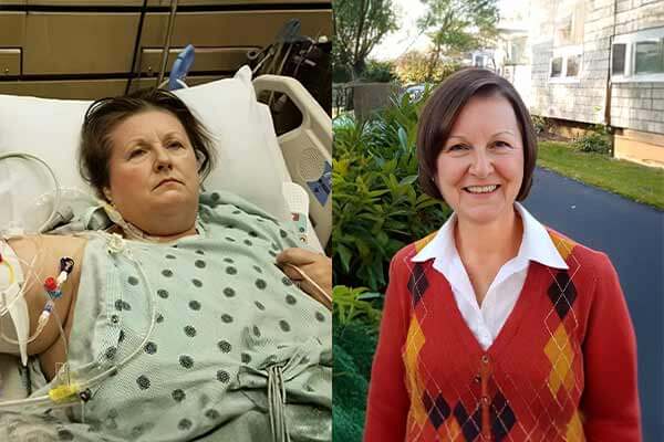 Heather's Mother Before and After